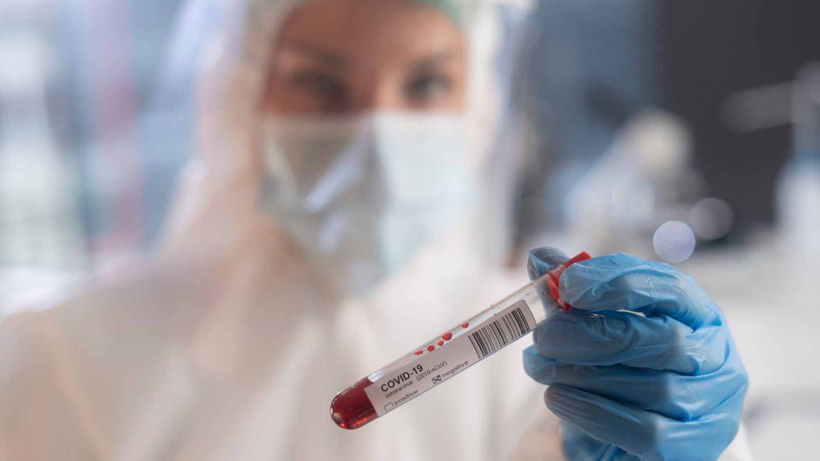 Um cientista examinando uma amostra de sangue em um tubo de ensaio com um adesivo indicando uma amostra negativa para coronavírus.